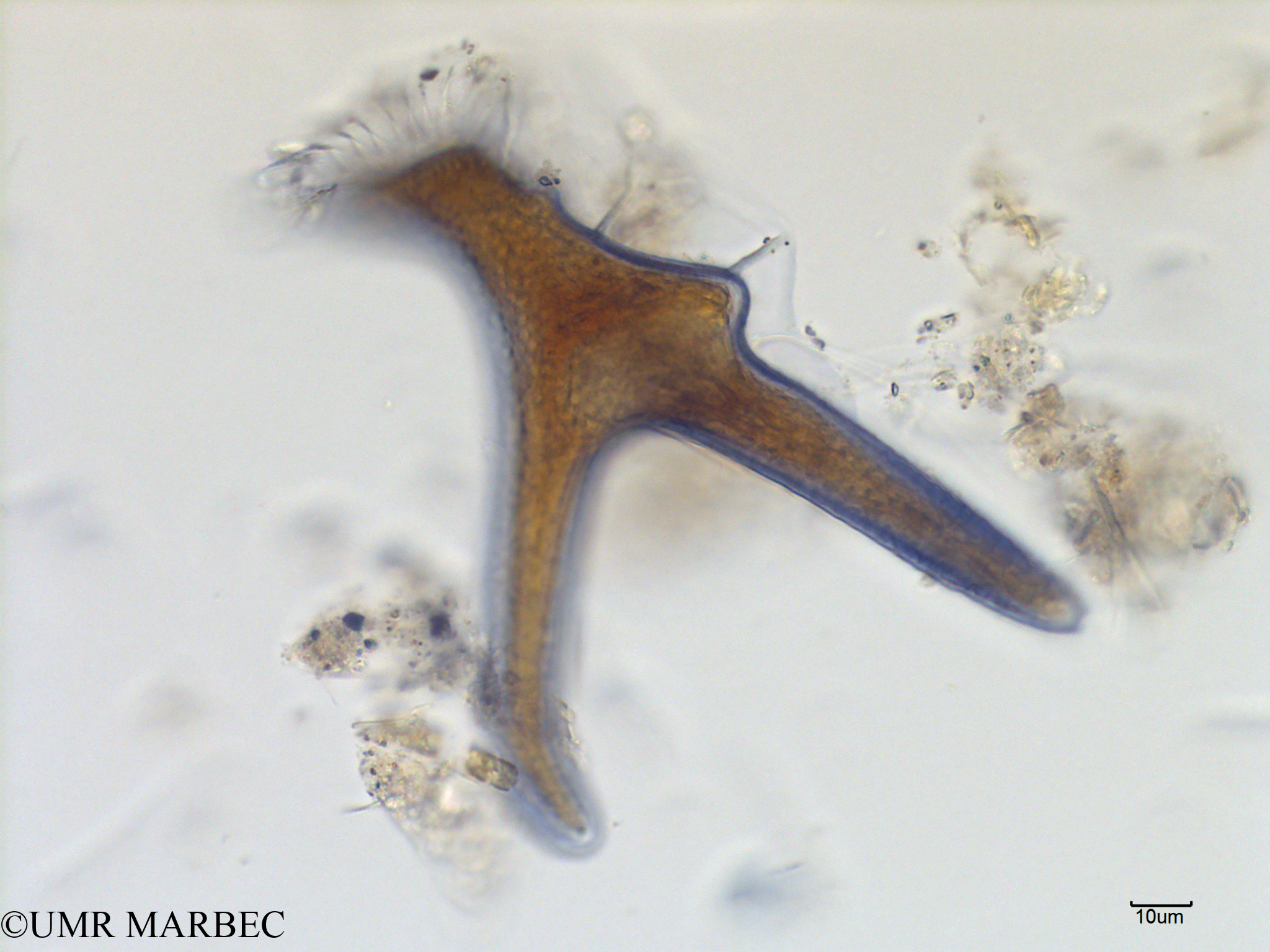 phyto/Scattered_Islands/mayotte_lagoon/SIREME May 2016/Dinophysis miles (MAY8_dino a identifier-20).tif(copy).jpg
